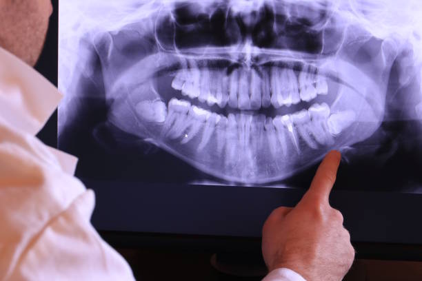 Best Emergency Dental Services for Seniors in Oasis, CA